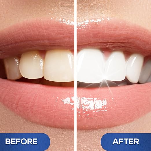 Dazzling Instant White Teeth Whitening Pen